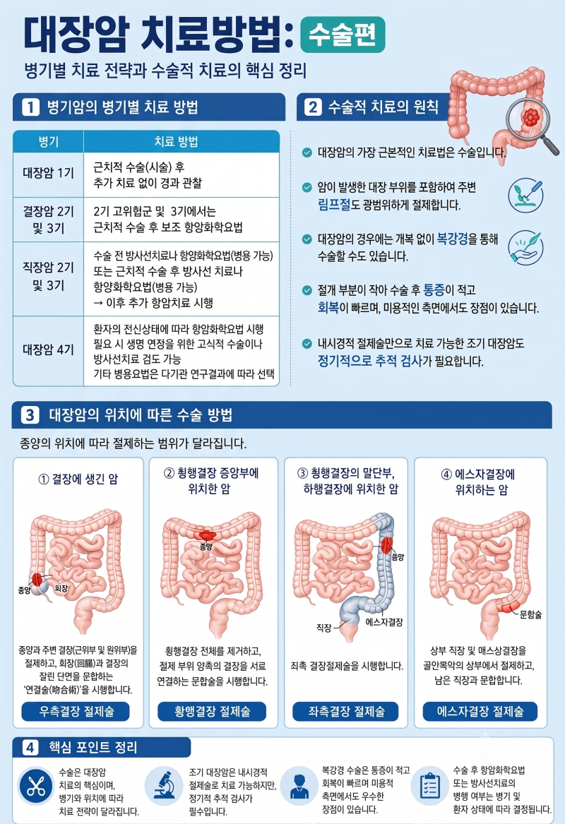 [대장암 치료방법 총정리] 수술부터 항암·방사선 치료까지 한눈에 보기!