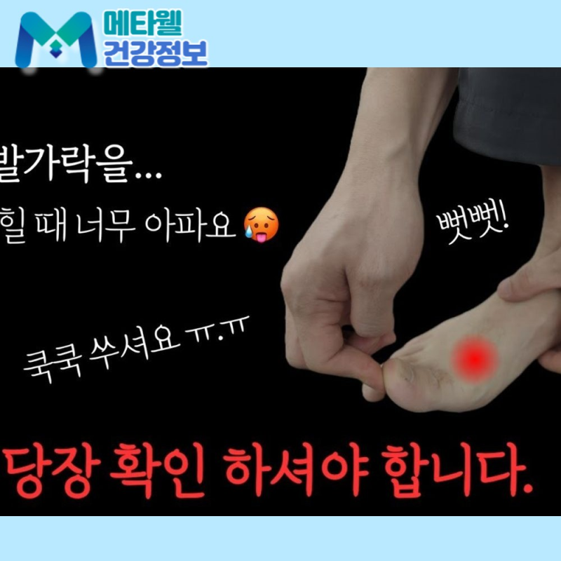 "단순 관절통이 아니었습니다" 류마티스내과 전문의가 강조하는 통풍 전조증상 5가지