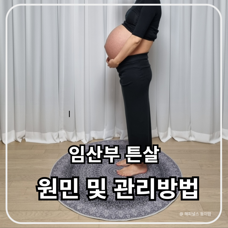 임산부 튼살 원인부터 관리 방법까지 정리