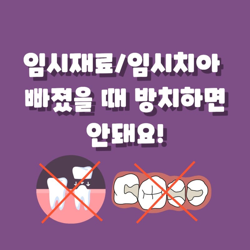 [마곡나루치과] 임시재료/임시치아 빠졌을 때 방치하면 안 되는 이유!