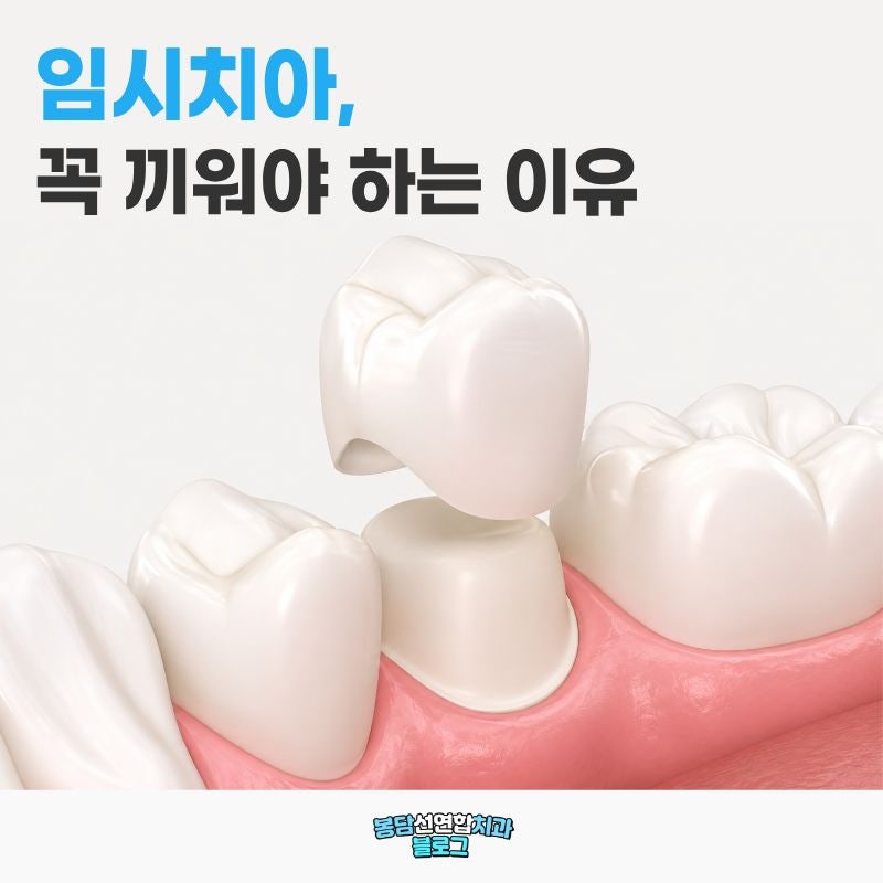화성치과 크라운 치료 중 임시치아, 왜 꼭 착용해야 할까요?