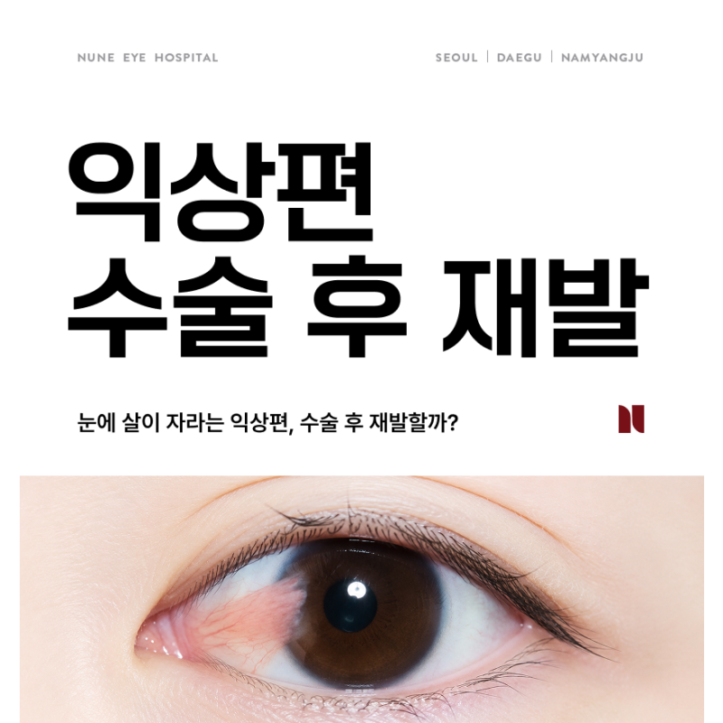 익상편 수술 후 재발할 확률은 얼마나 될까?