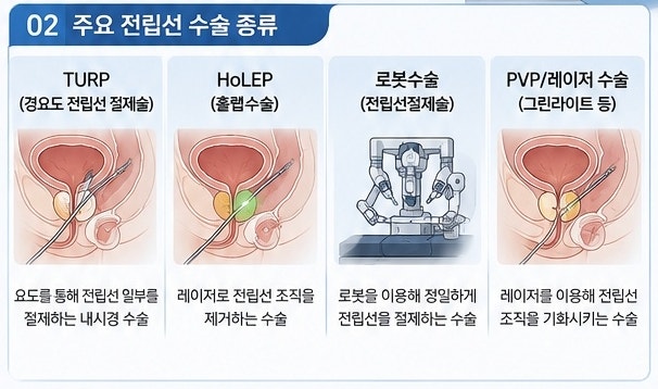 전립선비대증, 수술을 고민한다면! 수술방법과 보장항목, 청구서류까지 총정리