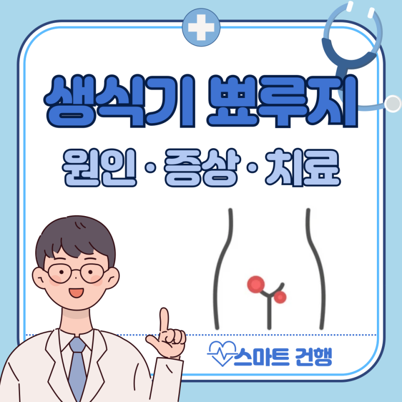여자 생식기 뾰루지 원인 5가지, 연고 : 여성 생식기 사마귀