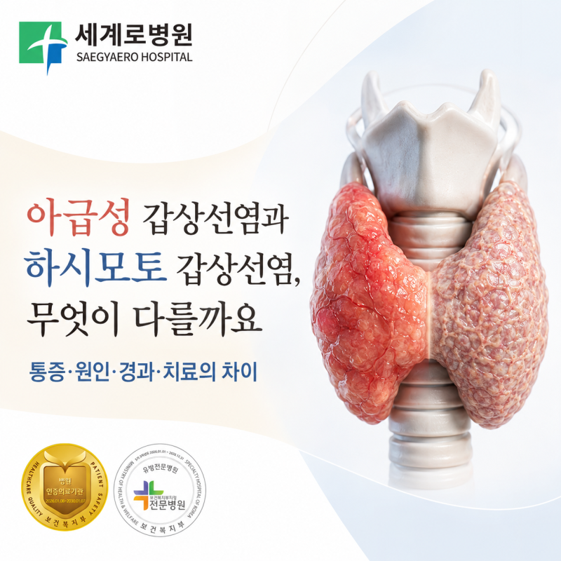 아급성 갑상선염과 하시모토 갑상선염, 무엇이 다를까요