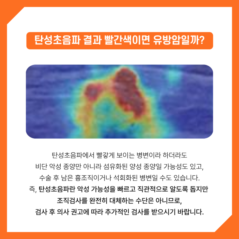 유방초음파 병원) 탄성초음파 결과 빨간색이면 유방암일까?