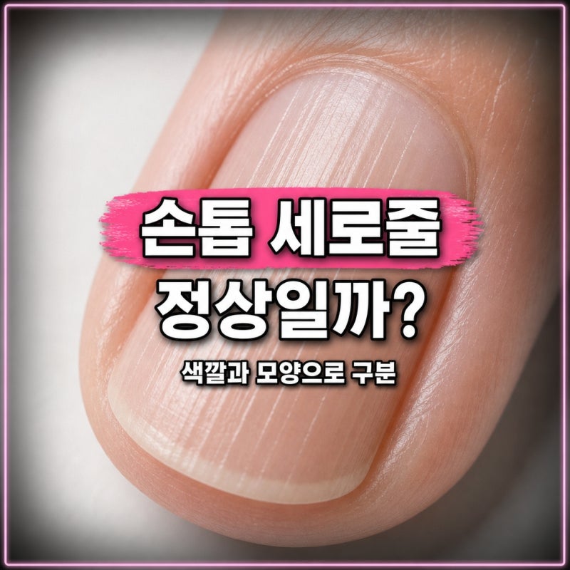 손톱 세로줄 원인, 검은 줄과 정상적인 줄 구분하는 방법