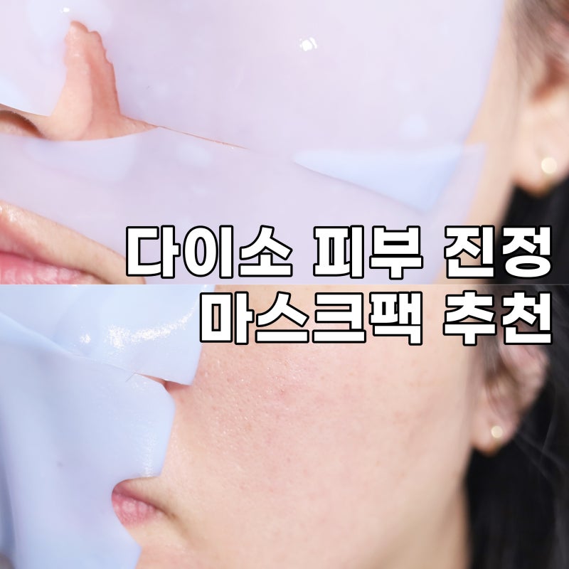 "누적판매 31만개..." 다이소 아줄렌 마스크팩 솔직후기