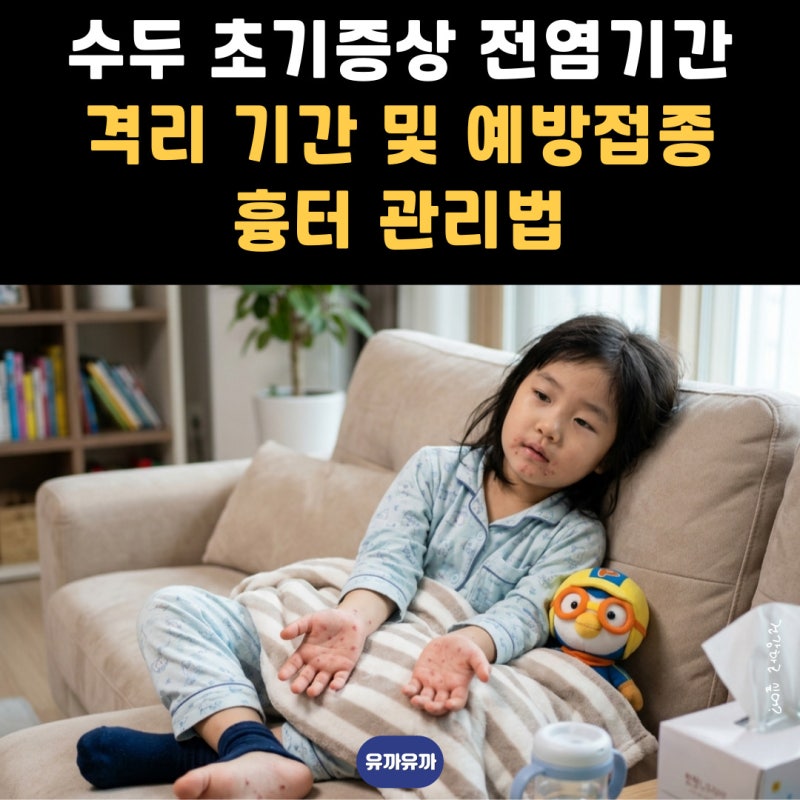 수두 초기증상 전염기간 격리 기간 및 예방접종 흉터 관리법