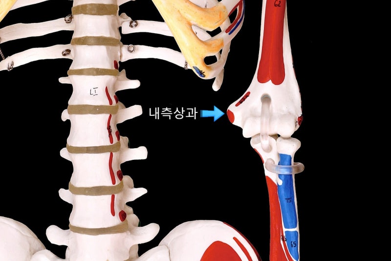 서귀포 통증 병원 - 팔꿈치 안쪽이 아프다면? 골프엘보 증상부터 원인, 치료 방법까지 알아보....