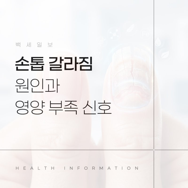손톱 갈라짐, 건조해서가 아닙니다 원인과 영양 부족 신호