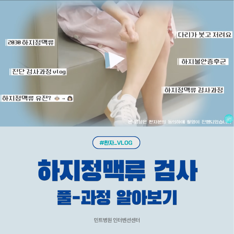 [하지정맥류 검사 후기] 도플러초음파 검사 과정부터 약 처방까지!
