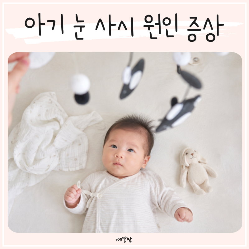 아기 눈 사시 신생아 유아 증상과 원인 총정리