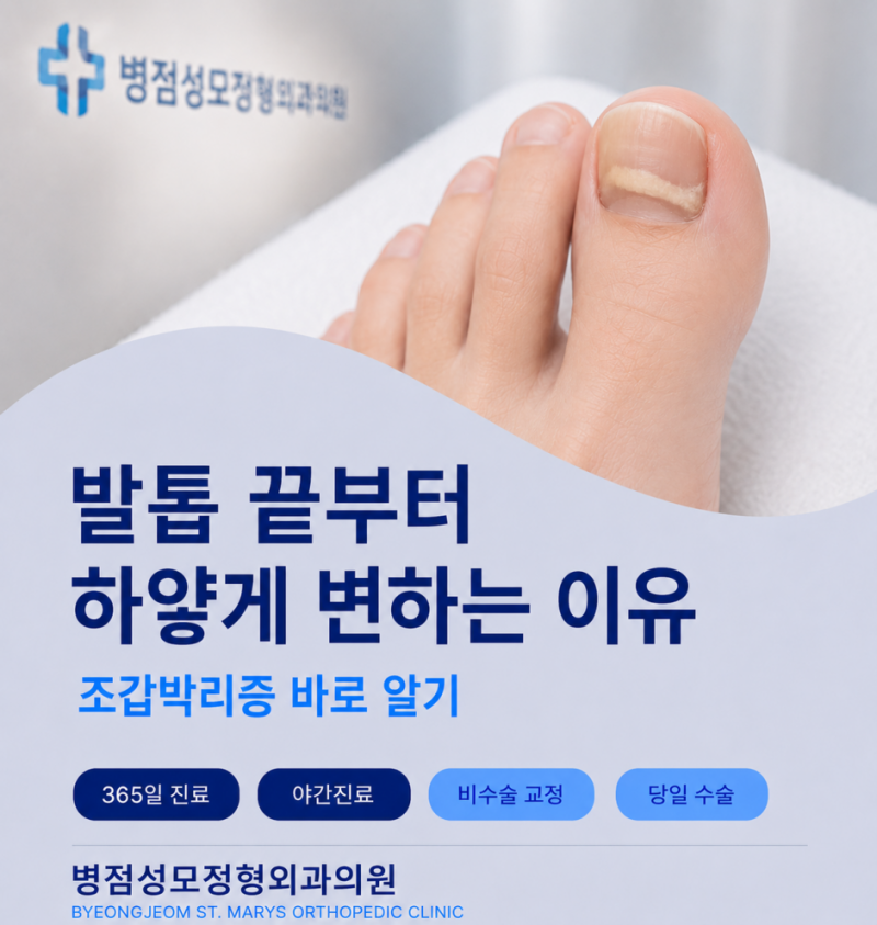 동탄발톱무좀 발톱 끝부터 하얗게 변하는 이유 조갑박리증 바로 알기