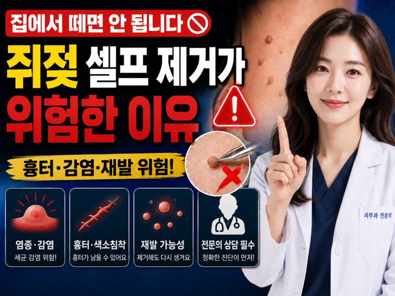 집에서 떼면 안 됩니다｜쥐젖 셀프 제거가 위험한 이유