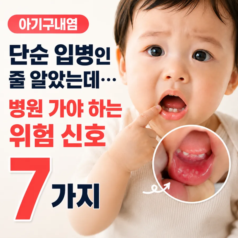 아기구내염, 단순 입병인 줄 알았는데… 병원 가야 하는 위험 신호 7가지