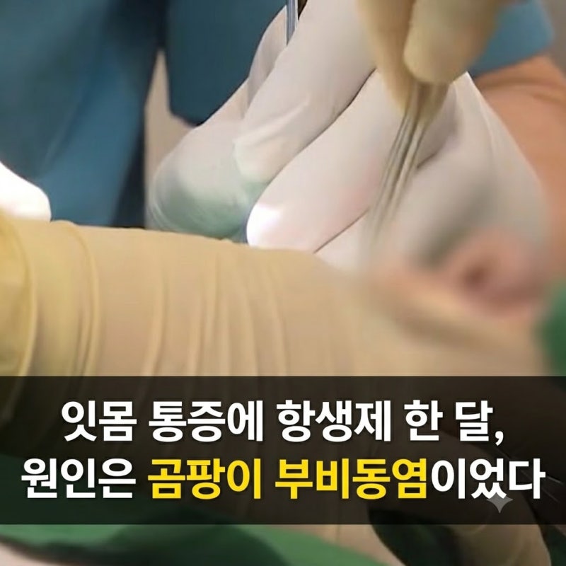 잇몸 통증에 항생제 한 달, 원인은 곰팡이 부비동염이었다