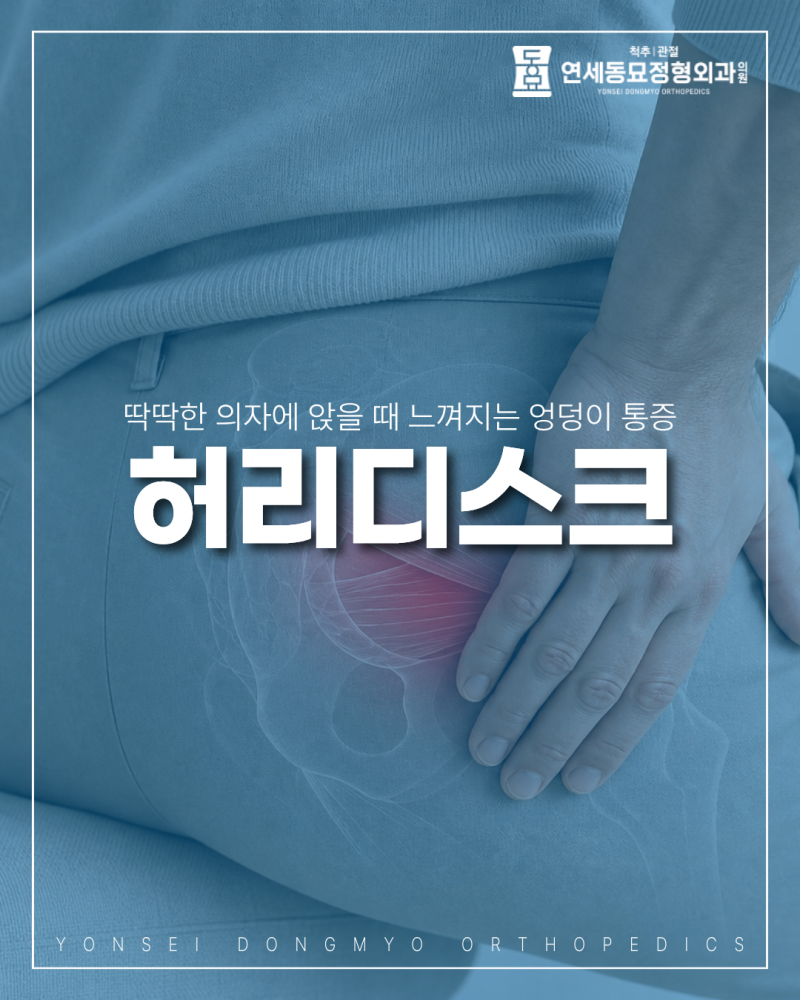 엉덩이 뼈 통증, 의자 엉덩이 통증, 좌골점액낭염 증상