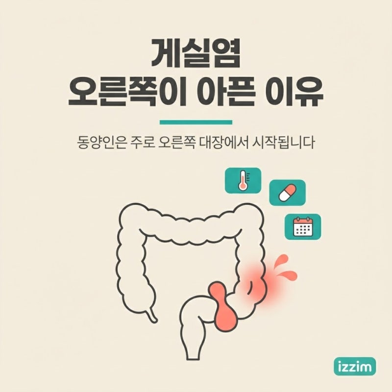 게실염 증상부터 원인·치료·음식까지, 맹장염과 헷갈리는 이유 총정리