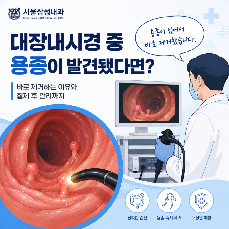[용인시 내과]대장내시경 중 용종이 발견됐다면어떻게 되는 건가요?