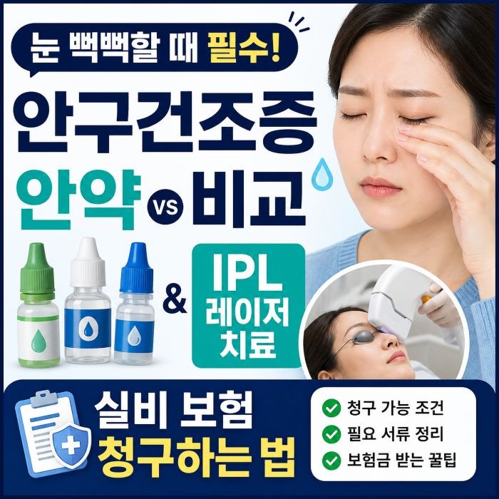 안구건조증 안연고 종류, IPL 레이저 얼마나 도움되나?