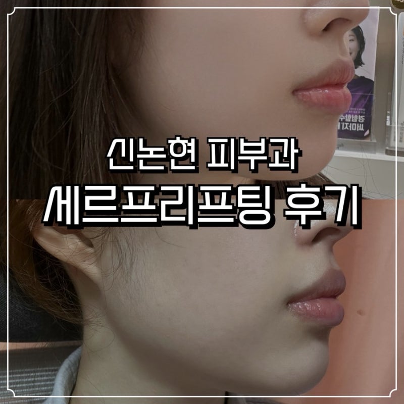 세르프리프팅 신논현피부과 볼 패임·라인 정리 솔직 후기