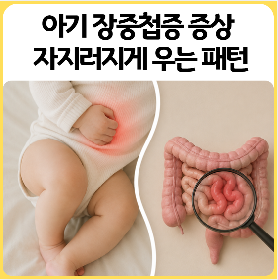 아기 장중첩증 | 증상과 원인, 영아산통과 헷갈렸던 이유