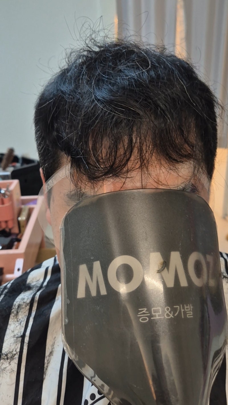 40대 탈모 포기 할건가요? 부산대표 증모술 성지 모모즈가 책임 질게요