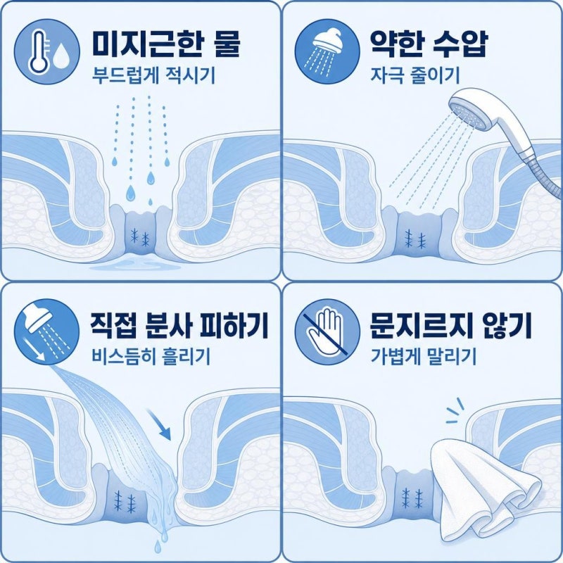 치질 수술 후 좌욕 대신 샤워기로 물 뿌려도 될까?