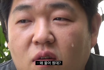 종로 탈모병원 성지 5가 탈모약 처방 후기 가격