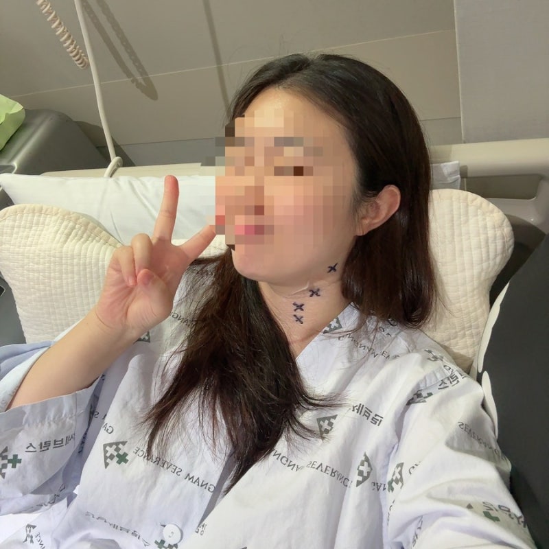 [갑상선암6]강남 세브란스 장항석 교수님/ 갑상선암 전이/ 양쪽 림프절 청소술/재발암/ 수술 ....