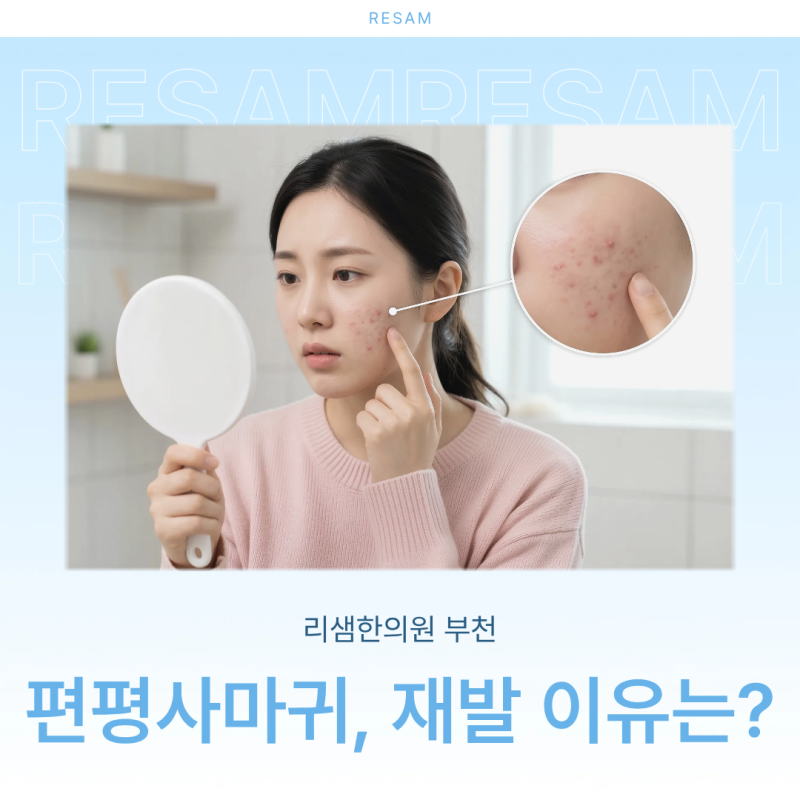 편평사마귀 제거, 왜 치료 후에도 자꾸 재발하는 걸까요? - 부천 리샘-