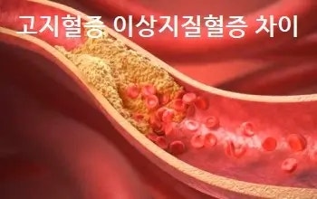고지혈증 이상지질혈증 차이