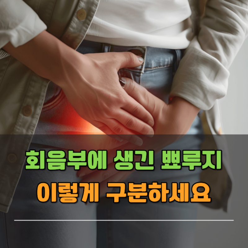회음부 뾰루지 통증 원인 여자 생식기 따가움