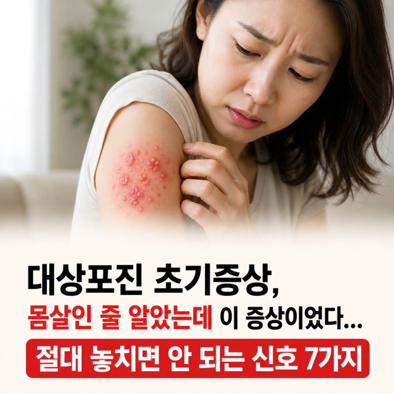 대상포진 초기증상, 몸살인 줄 알았는데 이 증상이었다… 절대 놓치면 안 되는 신호 7가지