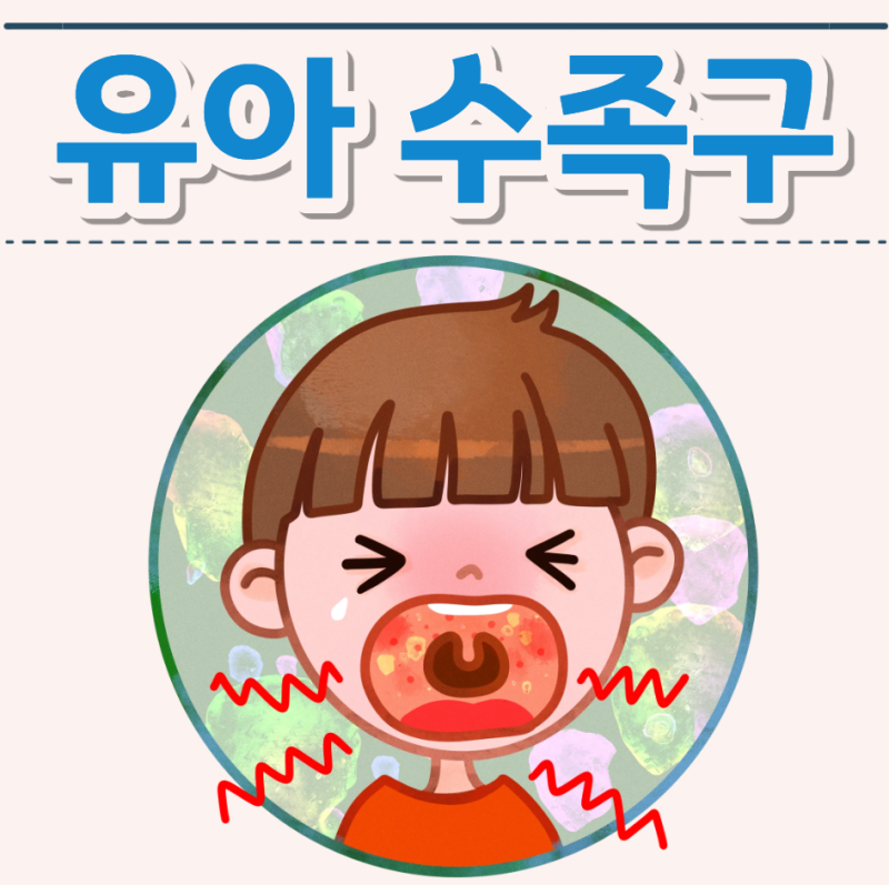 유아 수족구 증상과 잠복기: 전염성 높은 수족구병 완치 기간 및 격리 기준 총정리