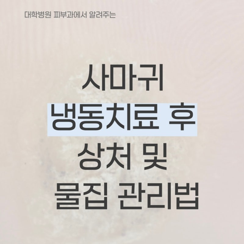 대학병원 피부과에서 알려주는 사마귀 냉동치료 후 상처 및 물집 관리법