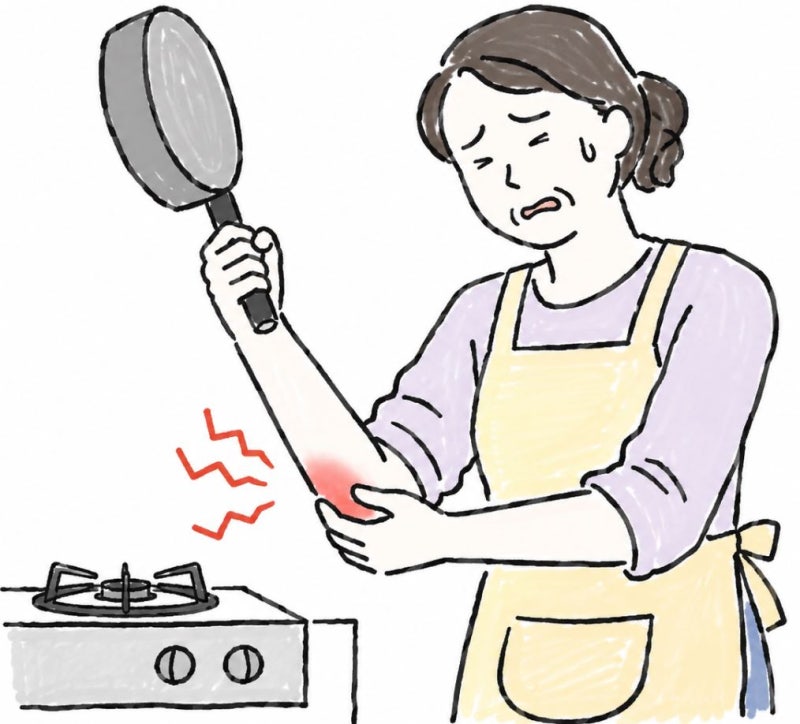 테니스도 안 치는데 왜 테니스 엘보일까? 바깥쪽 팔꿈치통증의 원인과 감별법