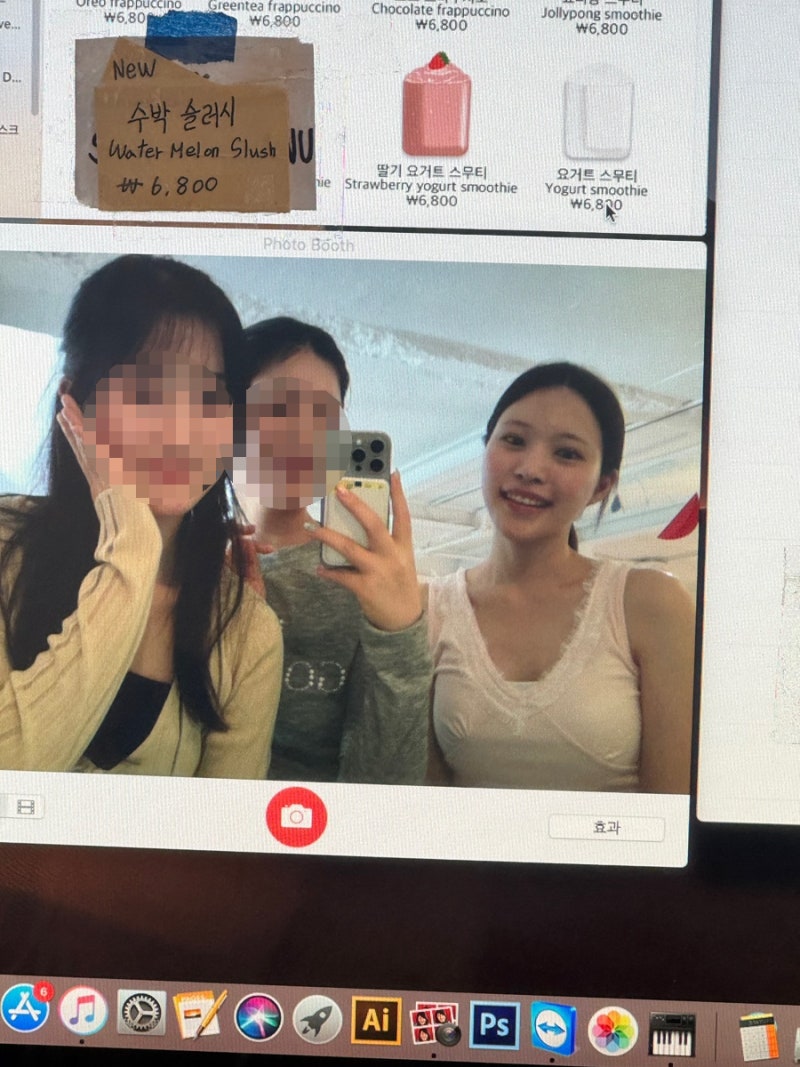 입술필러 녹임 (히알라제) 후기 | 입술필러 녹인 후 재시술 (벨로테로) 후기