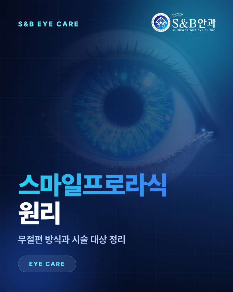스마일프로라식 방식과 대상 정리