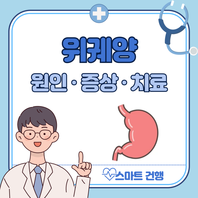 위궤양 증상, 원인, 치료법, 약 : 위궤양에 좋은 음식
