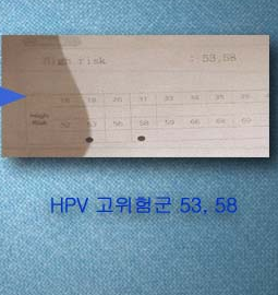 HPV 완치 후 다시 양성, 재감염일까 재발일까 잠복기일까?