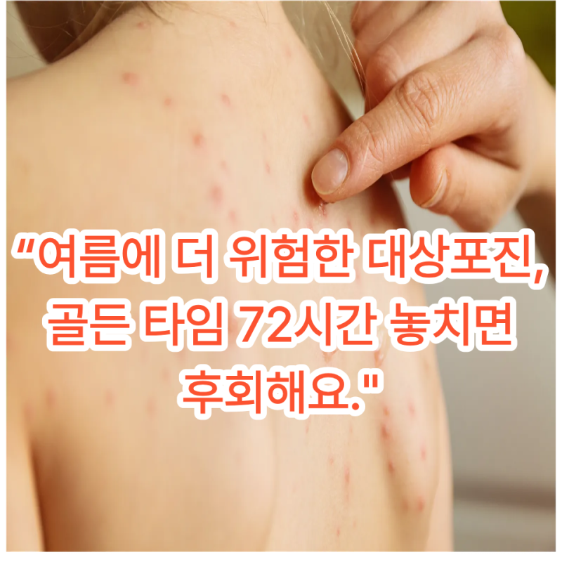 “여름철 체력 떨어지며 찌릿찌릿… 감기인 줄 알았는데 ‘대상포진’이었습니다 (초기 증....