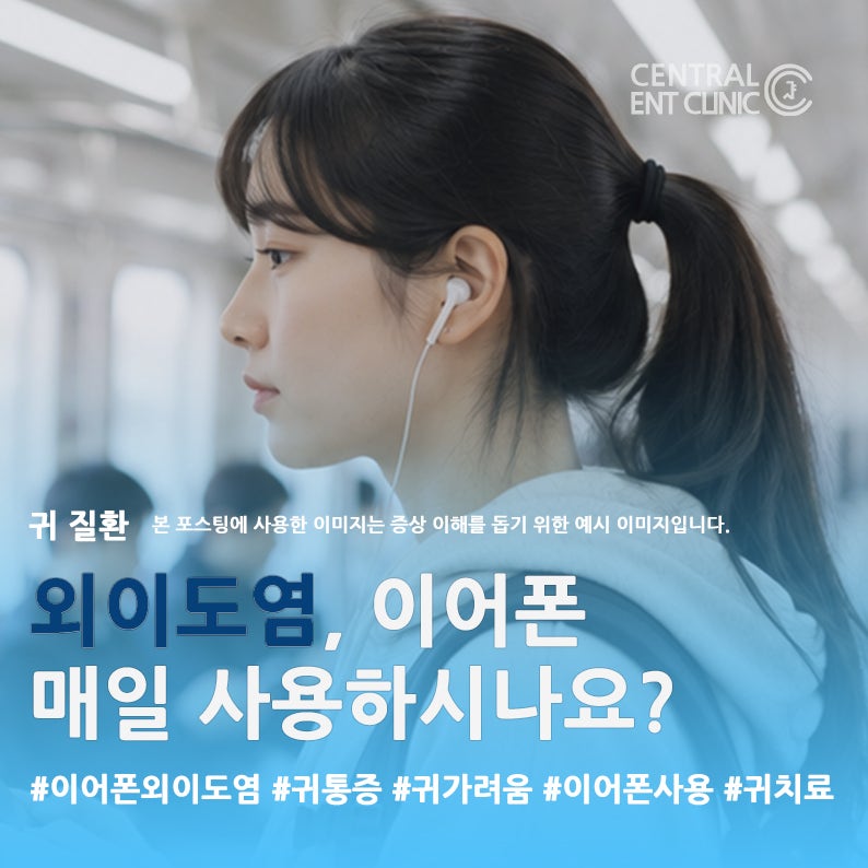 이어폰 오래 쓰면 외이도염 생길까요? 귀 건강을 지키는 습관