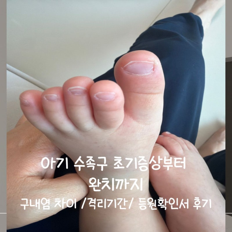 아기 수족구 초기증상부터 완치까지 | 구내염 차이·격리기간·등원확인서 후기