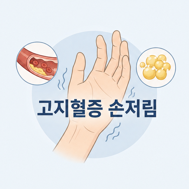 고지혈증과 손저림, 과연 직접적인 이유가 될까?