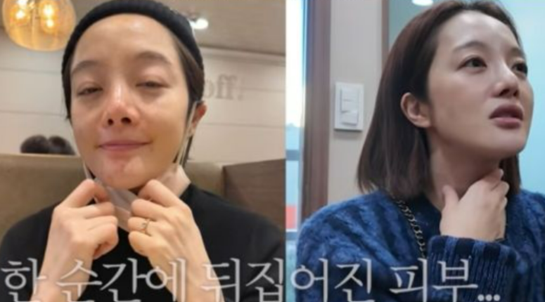"피부 좋다고 자만했는데…" 출산 후 기미·탄력 고민 털어놓은 황보라