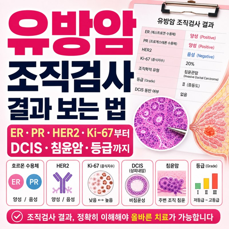유방암 조직검사 결과 보는 법: ER·PR·HER2·Ki-67부터 DCIS·침윤암·등급까지