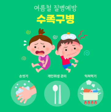 여름철 불청객 아기 수족구 초기증상 순서 및 잠복기 전염 격리기간 팩트체크