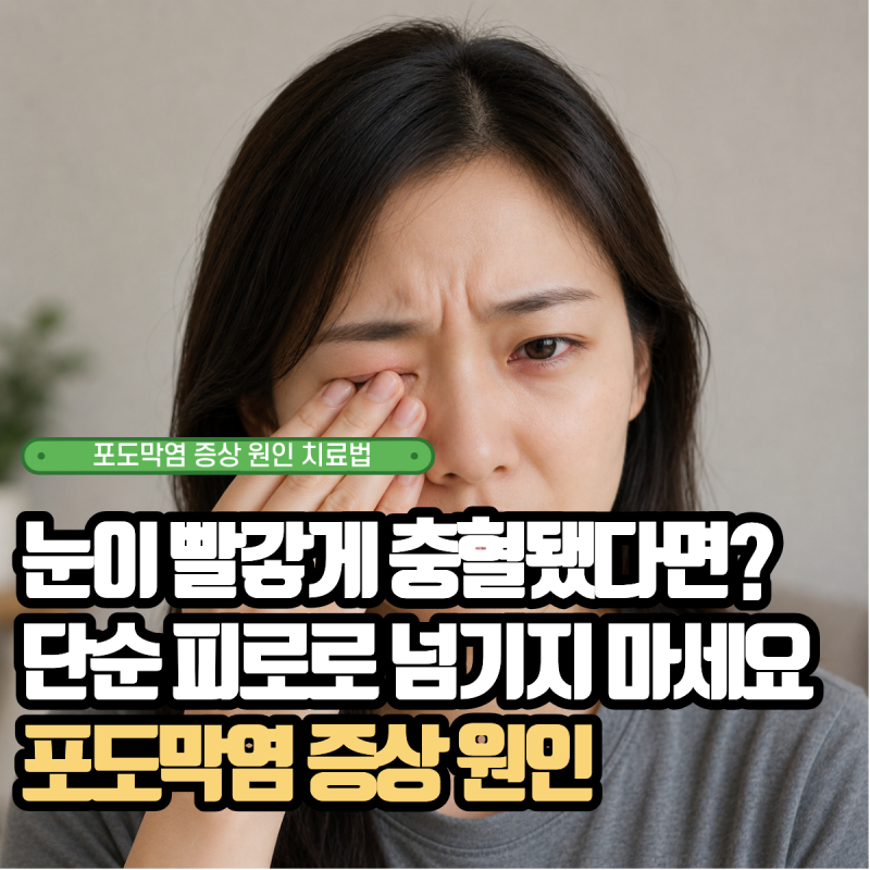 눈이 빨갛게 충혈됐다면? 단순 피로로 넘기지 마세요, 포도막염 증상 원인 치료법 정리